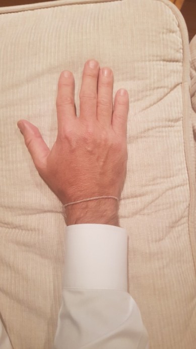 Bill's blessing sting